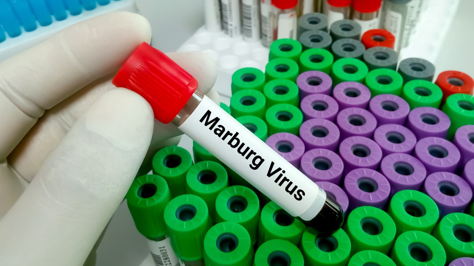 فيروس ماربورج الجديد.. الأعراض ونسبة الوفاة والعلاج